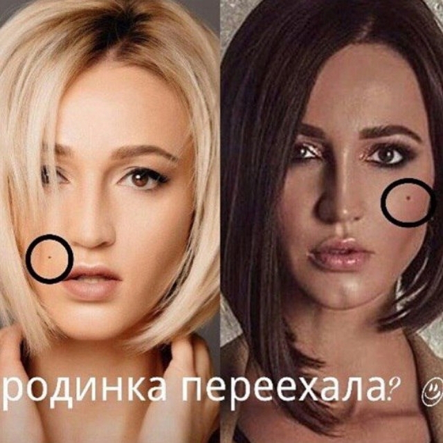 Блуждающая родинка Ольги Бузовой Блуждающая родинка Ольги Бузовой