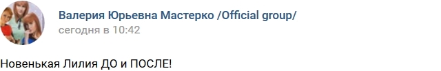 Новенькая Лилия до пластики Новенькая Лилия до пластики