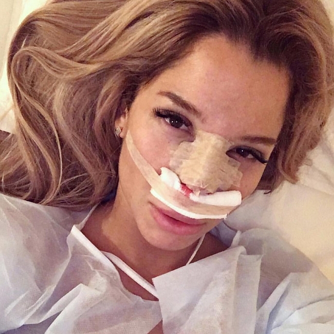 «СтарХит»: Катя Колисниченко вновь легла под нож «СтарХит»: Катя Колисниченко вновь легла под нож