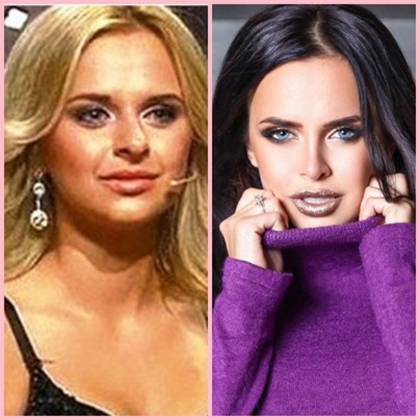 Звезды телестройки: До и после Звезды телестройки: До и после