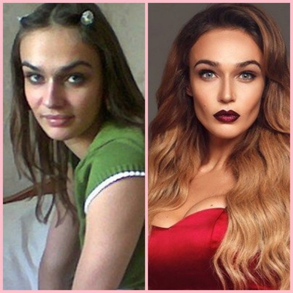 Звезды телестройки: До и после Звезды телестройки: До и после