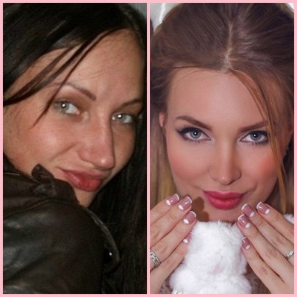 Звезды телестройки: До и после Звезды телестройки: До и после