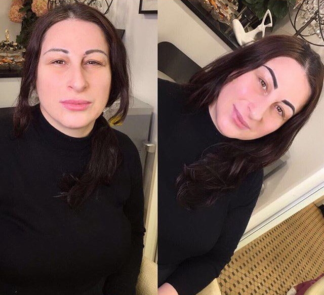 Марина Тристановна после омоложения Марина Тристановна после омоложения