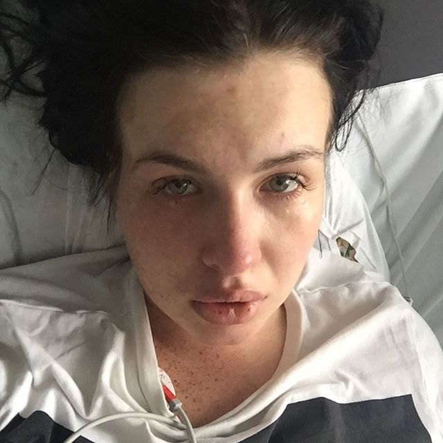 У Елены Степуниной диагностировали раковое заболевание У Елены Степуниной диагностировали раковое заболевание