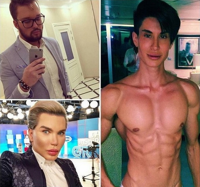 Егор Холявин и его «братья» по пластическим операциям Егор Холявин и его «братья» по пластическим операциям