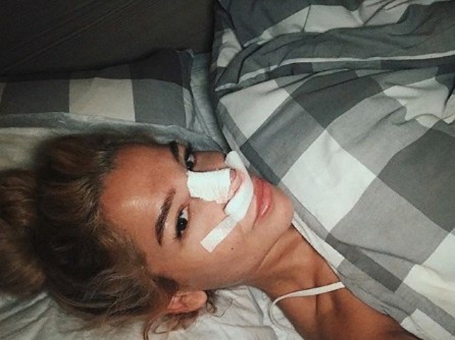 Екатерина Колисниченко: Ура! У меня новый носик! Екатерина Колисниченко: Ура! У меня новый носик!