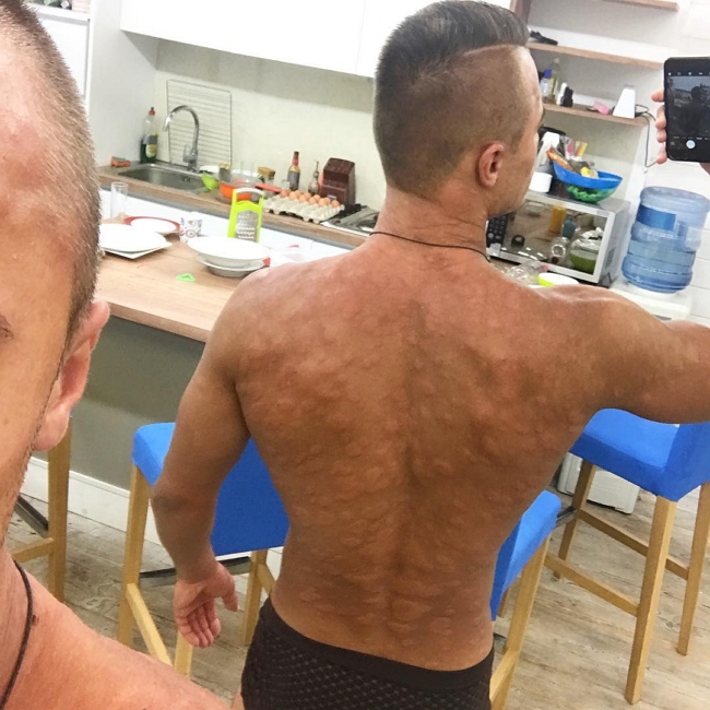 Алексей Купин загремел на больничную кровать Алексей Купин загремел на больничную кровать