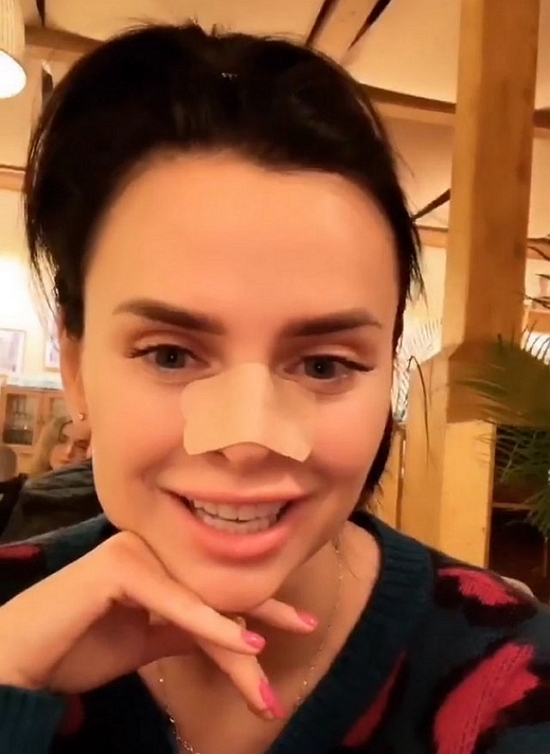 У Виктории Романец проблемы с носом У Виктории Романец проблемы с носом