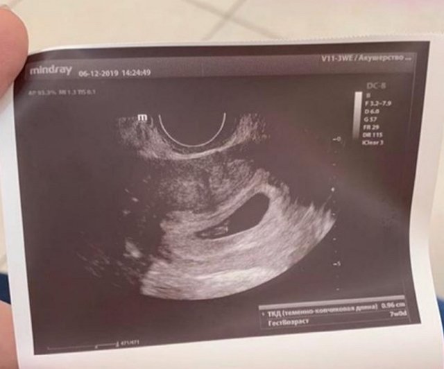 Новости журнала Дом-2 (10.05.2020) Новости журнала Дом-2 (10.05.2020)