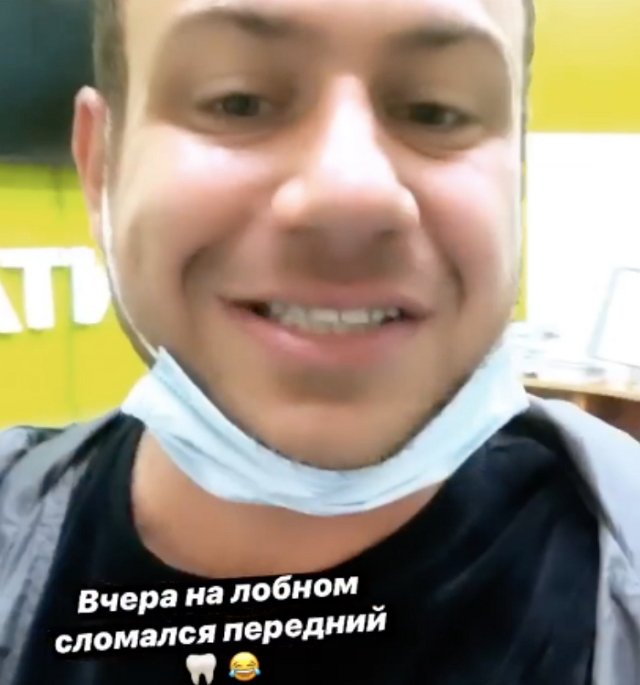 Валера Блюменкранц починил отломавшийся зуб Валера Блюменкранц починил отломавшийся зуб