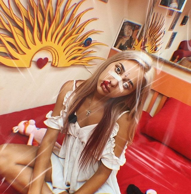 Анастасия Стецевят: Он упал и специально прикусил губу Анастасия Стецевят: Он упал и специально прикусил губу