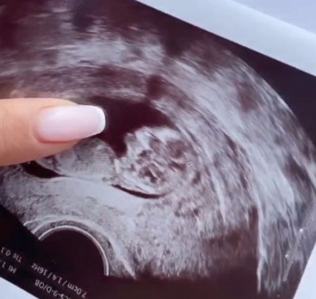 ��� � ������ ����������� ������ ��� �������� ������