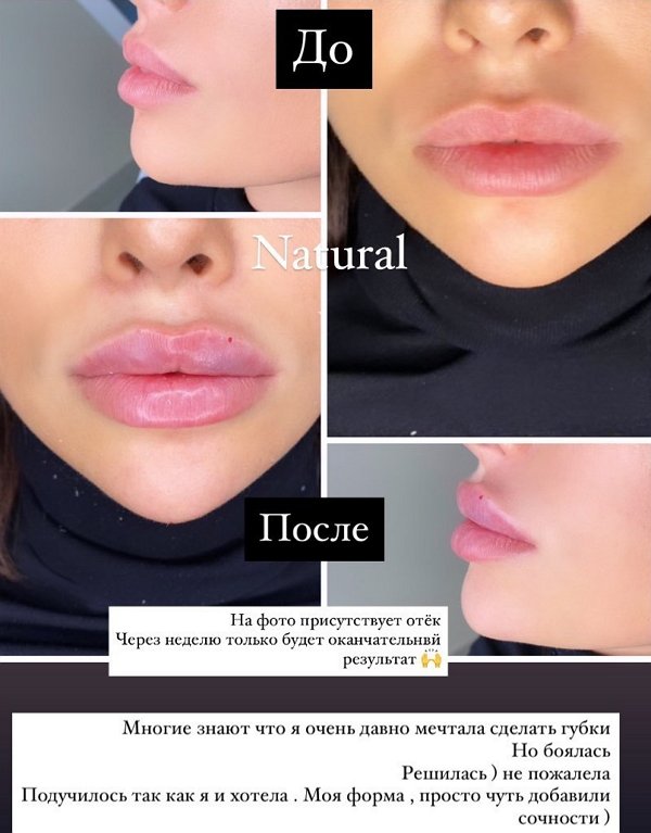 ����� ��������: ����� ������� ��� �������