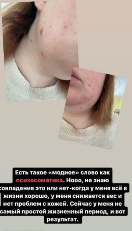 Александра Черно: Есть такое явление - психосоматика Александра Черно: Есть такое явление - психосоматика