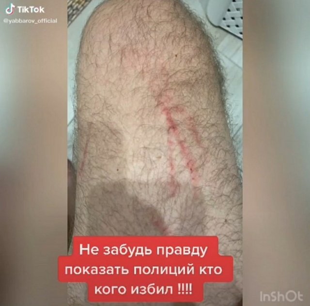 Илья Яббаров: Настя вызвала полицию Илья Яббаров: Настя вызвала полицию