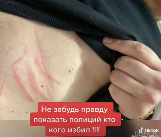 Илья Яббаров: Настя вызвала полицию Илья Яббаров: Настя вызвала полицию