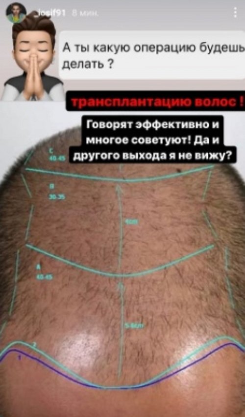 Иосиф Оганесян: Она меня не отпускает в Турцию Иосиф Оганесян: Она меня не отпускает в Турцию