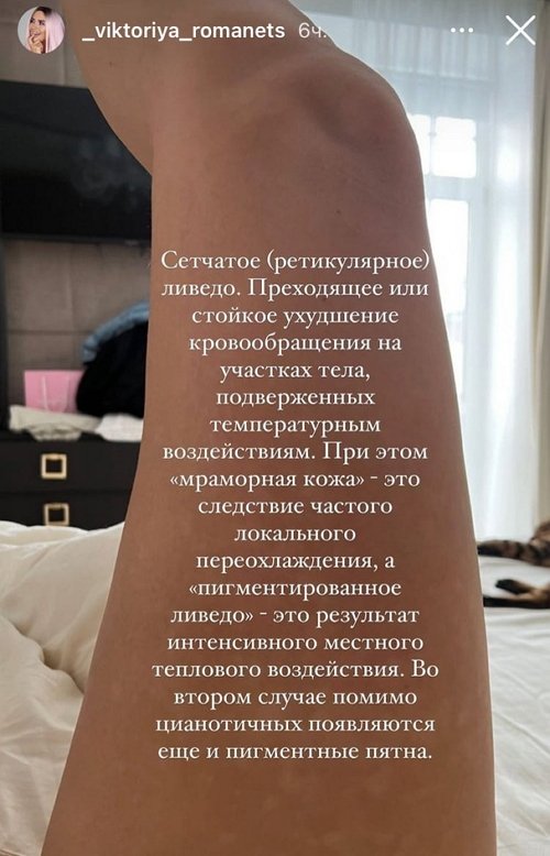 Виктория Романец: Это не лишай и не грибок Виктория Романец: Это не лишай и не грибок