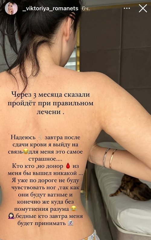 Виктория Романец: Это не лишай и не грибок Виктория Романец: Это не лишай и не грибок