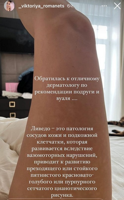 Виктория Романец: Это не лишай и не грибок Виктория Романец: Это не лишай и не грибок