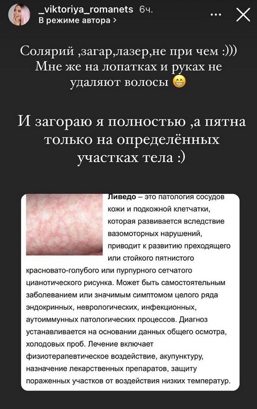 Виктория Романец: Это не лишай и не грибок Виктория Романец: Это не лишай и не грибок