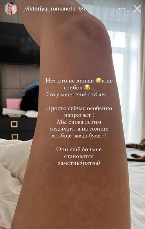 Виктория Романец: Это не лишай и не грибок Виктория Романец: Это не лишай и не грибок