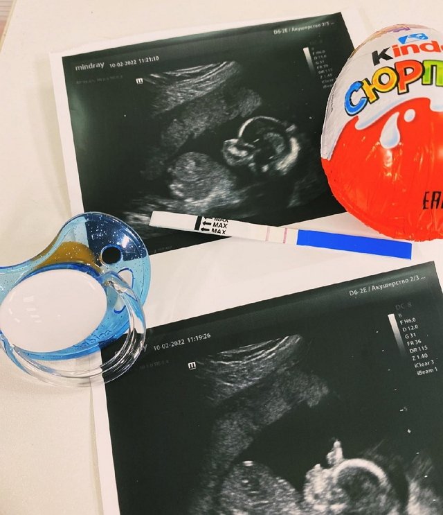 ������� ������: ��� ������ � �� ��������