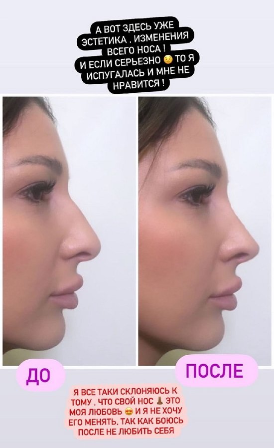 Яна Захарова: Я решила ничего не делать Яна Захарова: Я решила ничего не делать