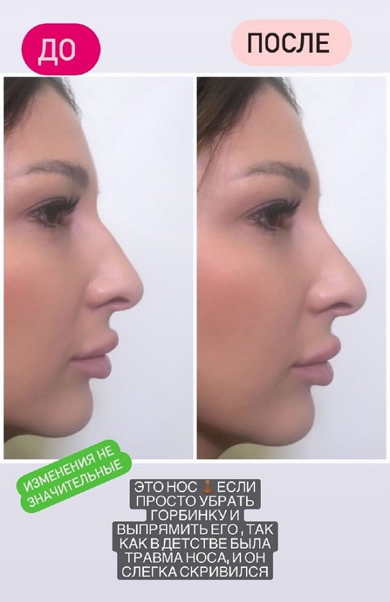 Яна Захарова: Я решила ничего не делать Яна Захарова: Я решила ничего не делать