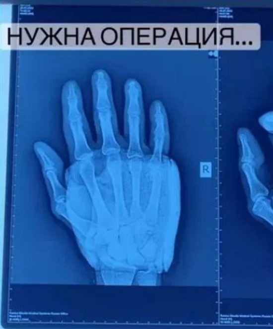 ����� ����������� �� ������� ��������