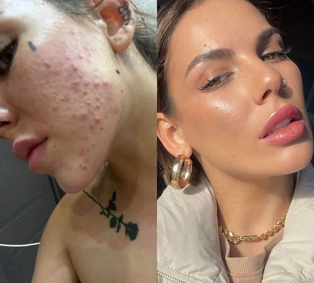 ���� ���������: ��� ��-�� ������� � ������������� ����