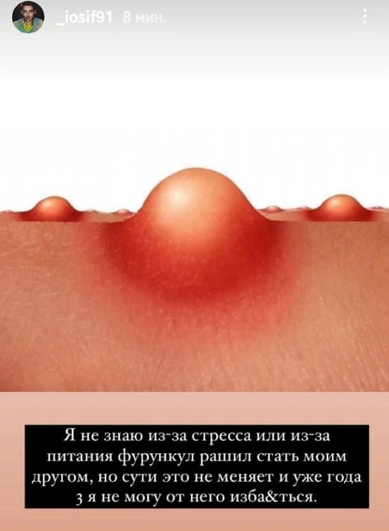 ����� ��������: �������� ����� ����� ���� ������