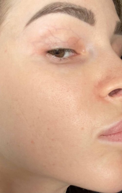 ��������� ����: ���� ��� ��������