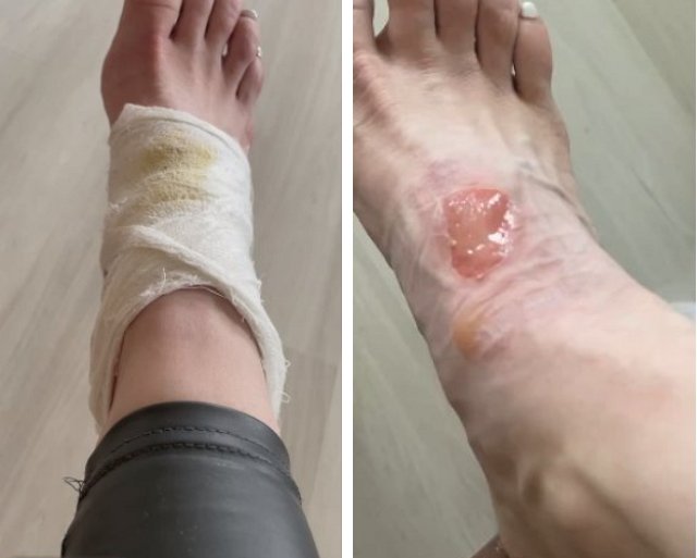 ������ �����: ���-�� ������ ���������� ������ ����