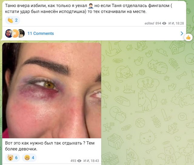 Сестру Александры Черно избили в ночном клубе Сестру Александры Черно избили в ночном клубе