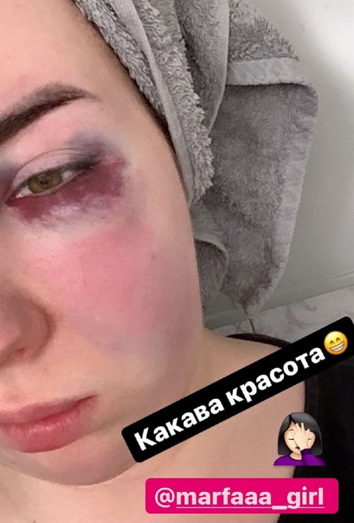 Сестру Александры Черно избили в ночном клубе Сестру Александры Черно избили в ночном клубе