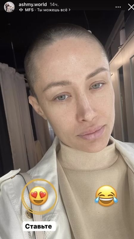 Побритая налысо Алёна Ашмарина показала, как выглядит без макияжа перед операцией Побритая налысо Алёна Ашмарина показала, как выглядит без макияжа перед операцией