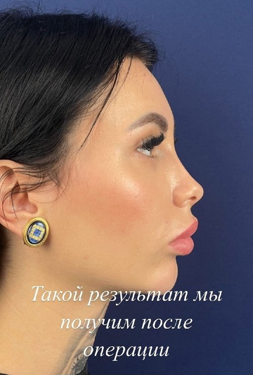 ������� ���������� ��������� � ������������