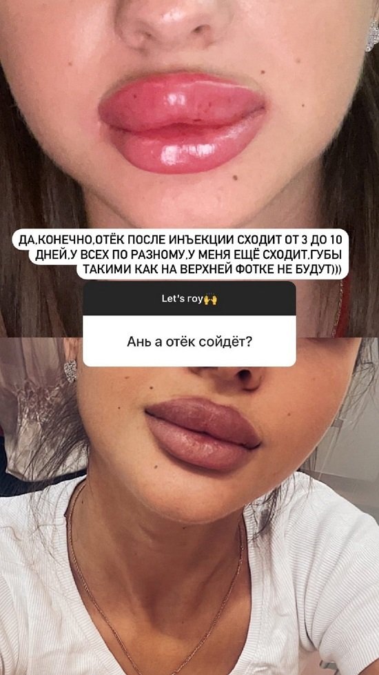 ���� ��������: ������� ���������� ���-�� �����