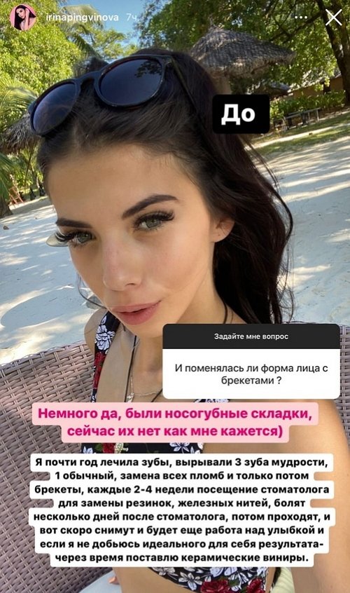 Ирина Пингвинова: Нормальная она, не придирайтесь Ирина Пингвинова: Нормальная она, не придирайтесь