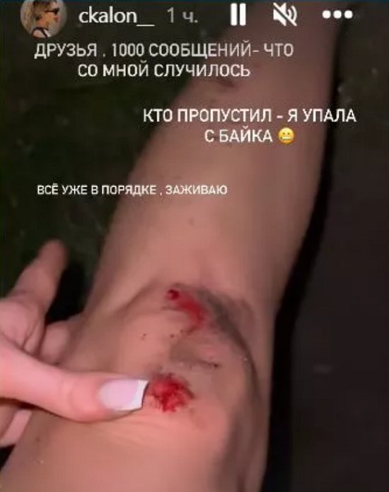 Скалон грустит на Бали в одиночестве и мечтает о мужчине Скалон грустит на Бали в одиночестве и мечтает о мужчине