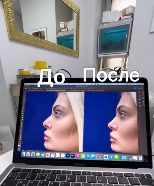 ���� ������: ��������� ��� �����