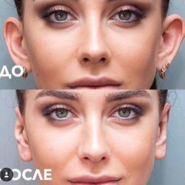 Марина Африкантова: Ушастая красавица. Это гены, Рома Марина Африкантова: Ушастая красавица. Это гены, Рома