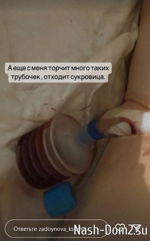 Ксения Задойнова: Болит всё ужасно!