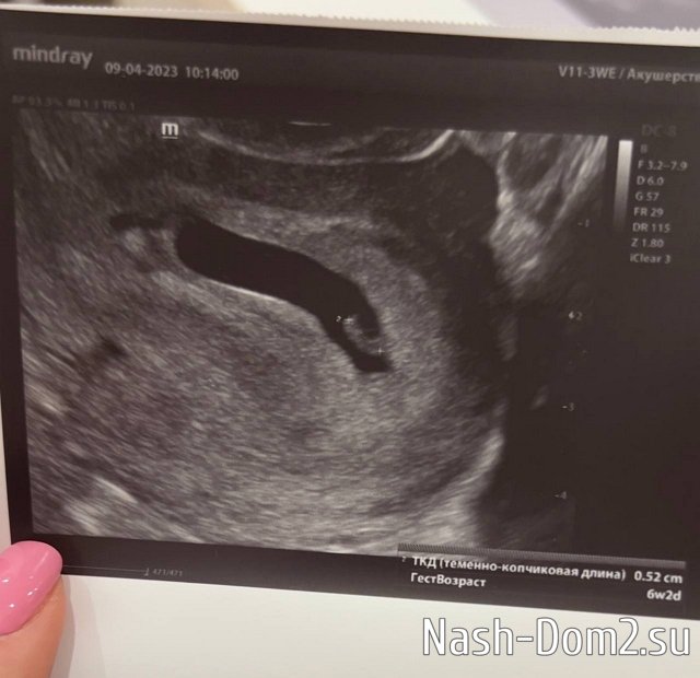 Елизавета Полыгалова: Нам уже почти 7 недель Елизавета Полыгалова: Нам уже почти 7 недель