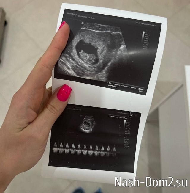 Елизавета Полыгалова: Мой пупсик размером с креветку! Елизавета Полыгалова: Мой пупсик размером с креветку!