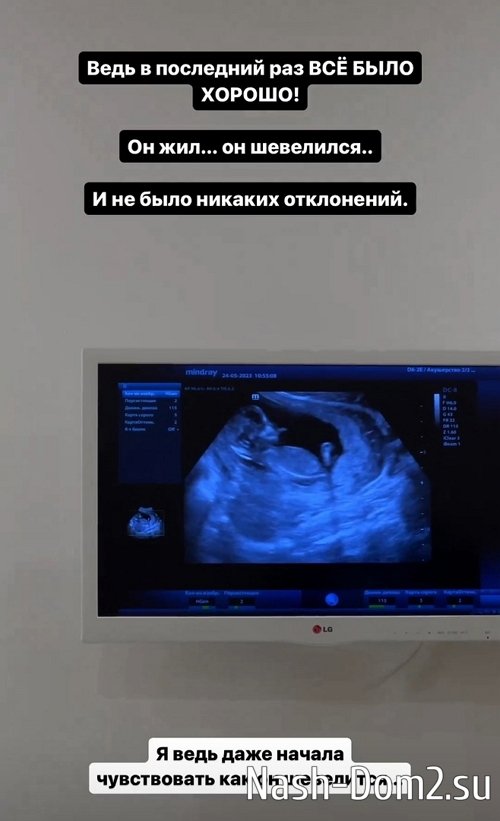 Елизавета Полыгалова: Я какая-то не такая?! Елизавета Полыгалова: Я какая-то не такая?!