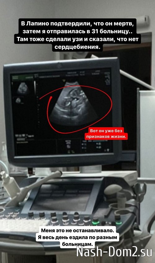 Елизавета Полыгалова: Я какая-то не такая?! Елизавета Полыгалова: Я какая-то не такая?!