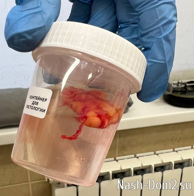 ���� ��������: � ������� ������