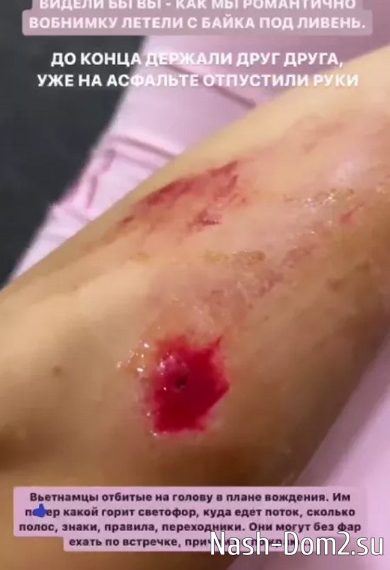 Ромашовы попали в аварию во Вьетнаме Ромашовы попали в аварию во Вьетнаме